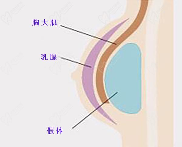 戴洪芸17分钟极速丰胸技术优势