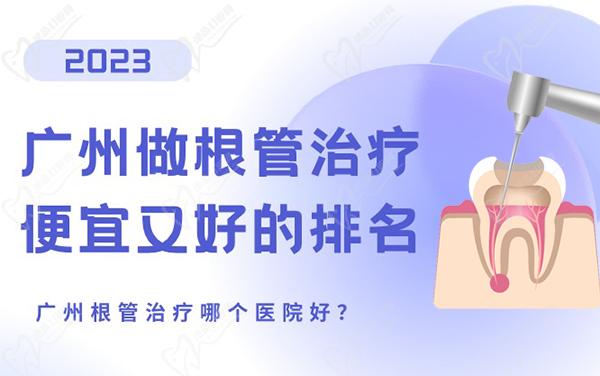 广州根管治疗哪个医院好？广州做根管治疗便宜又好的口腔排名在本文