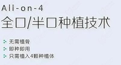 东莞种植牙多少钱一颗2024年价格