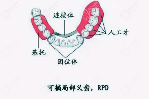 哪些情况下需要使用假牙？