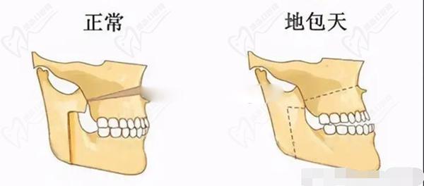 西安做正颌手术的医院哪家好？西安正颌手术医院排名前十