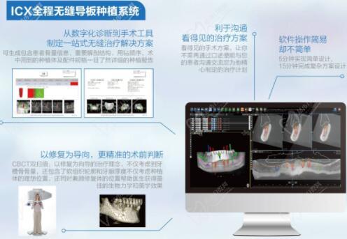 湛江珠江口腔医院靠谱吗