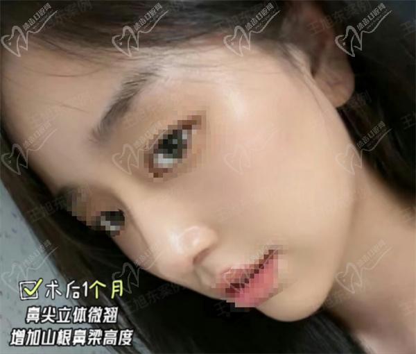 北京美莱王旭东医生简介