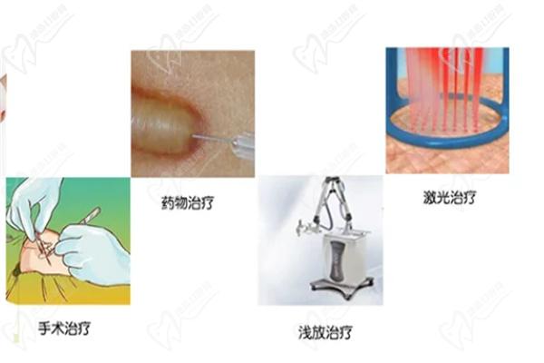 韩国疤痕修复优势