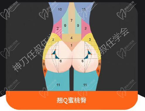 北京禾美嘉的任学会医生丰臀