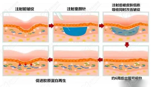 艾维岚的功效和优势