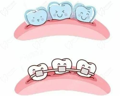 南京金铂利口腔隐形牙齿矫正好吗
