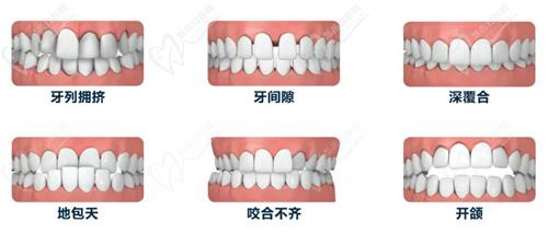 酒泉口腔医院牙齿矫正价格表