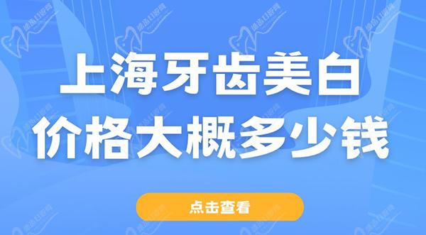 上海牙齿美白价格大概多少钱左右？上海牙齿美白价格收费表一键查询