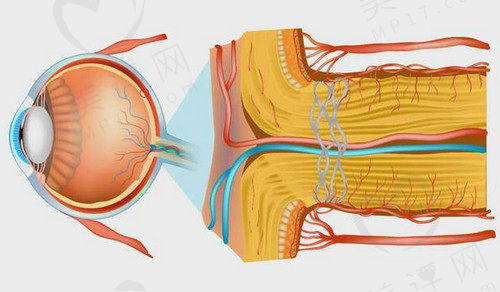 视神经萎缩怎么造成的