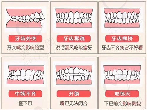 隐形矫正