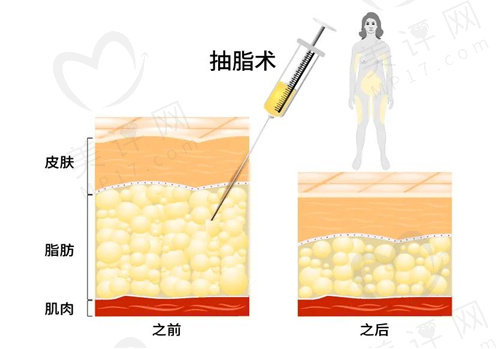 南京陈孝闯医生真的好