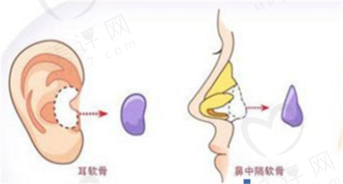 郭树忠做耳再造技术怎么样