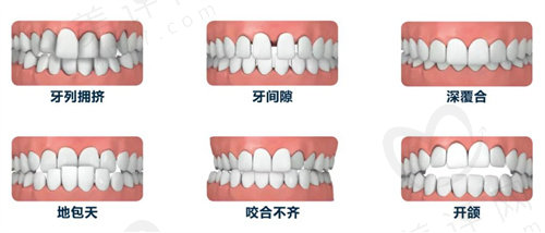 深圳马泷齿科做牙齿矫正怎么样？