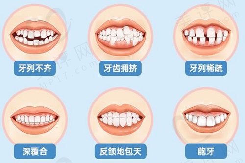 潘超医生在正畸技术方面的优势