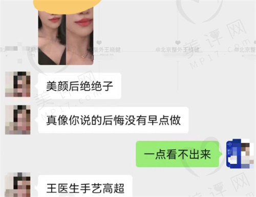 王晓健人中缩短做得好