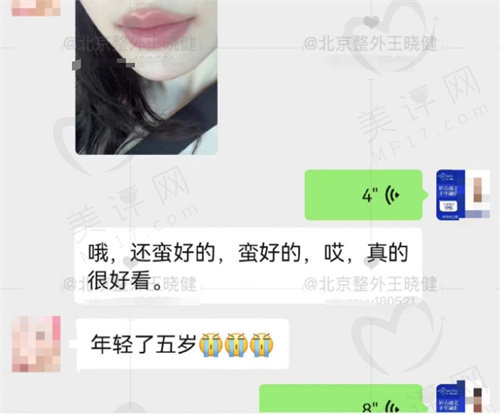 北京王晓健做人中缩短好评