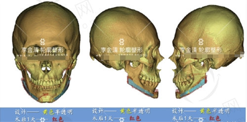 西安李金清医生