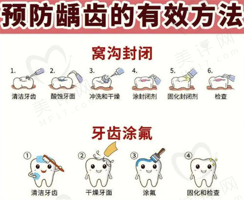 预防蛀牙的有效方法