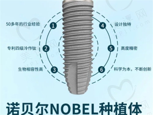 瑞典诺贝尔和瑞士iti种植牙的区别