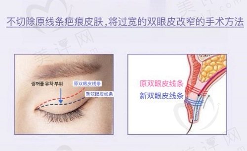 洪星杓医生医疗背景