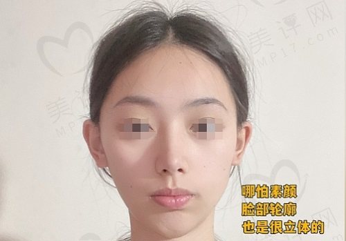 深圳艺星文丰做鼻子口碑好