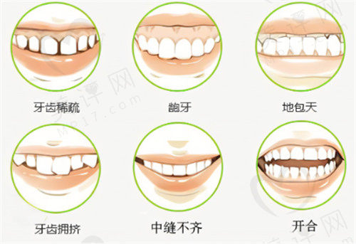 需要矫正的牙齿类型