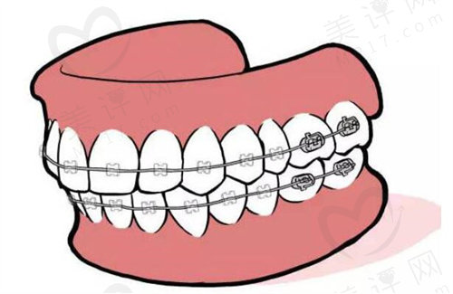 深圳马泷齿科正畸价格