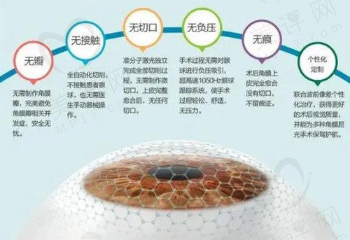 smart全激光手术的优缺点有哪些