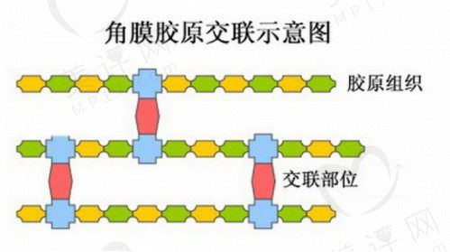 角膜交联手术成功几率高吗