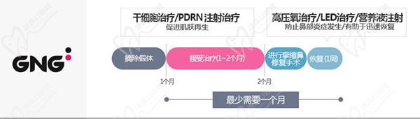 韩国gng医院鼻修复怎么样？假体外露-鼻孔挛缩-假体移位都可修复