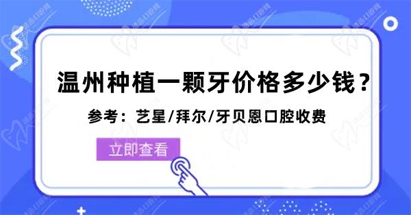 温州种植一颗牙价格