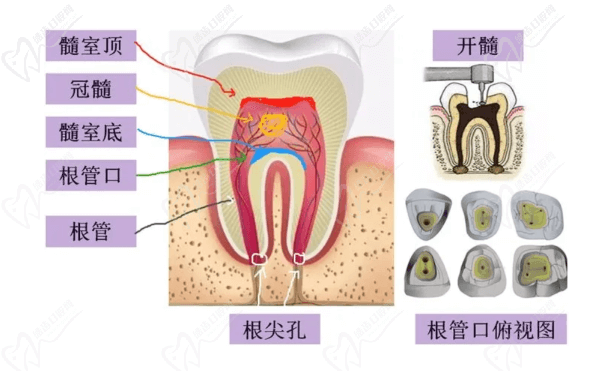 根管俯视图