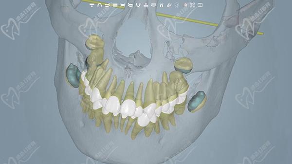 莆田齿小护口腔诊所口碑点评