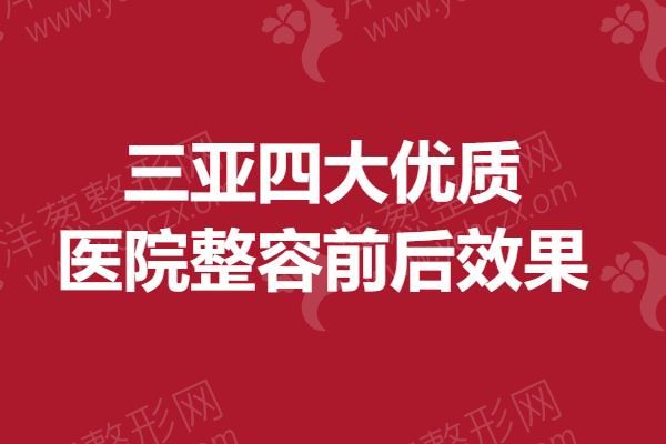 三亚四大优质医院整容前后果对比图.png