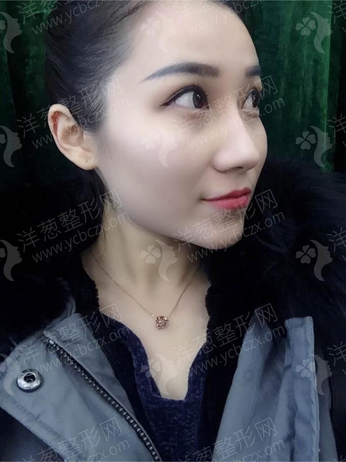 术后.jpg