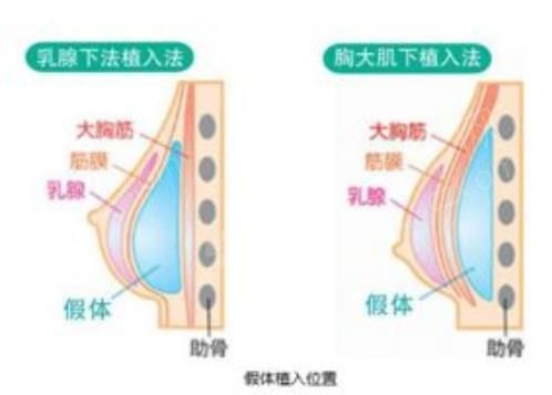 微信截图_20230417172611.jpg